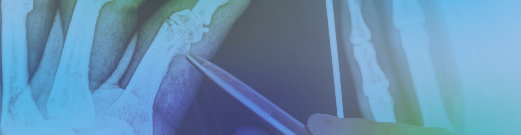 Orthopedics